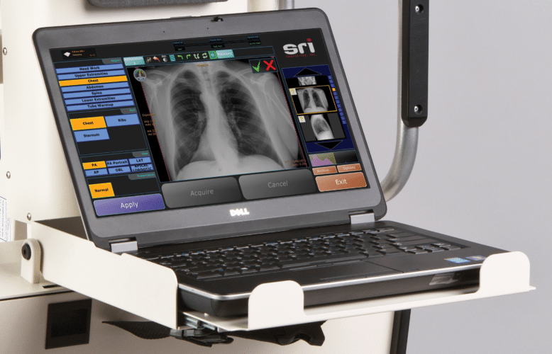 The Benefits Of Going Digital With Portable X-Ray Systems