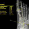 2020 PXS710 DR Podiatry X-Ray img 6