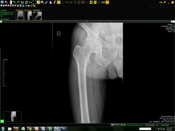 Konica Opal-RAD MiniPACS | MiniPACS Systems | Dicom Solution