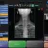 Vizion U-Arm Orthopedic X-ray img 3