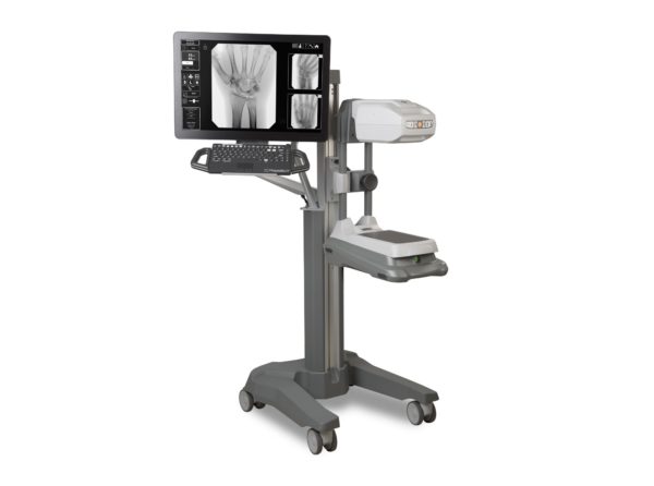 OrthoScan Mobile DI Mobile DI is the first and only mini C-arm designed specifically for your clinical and off-site imaging requirements. Couple portability and ease of movement with industry-leading digital X-ray and fluoroscopy. Offer supplementary procedures with established CPT codes for increased reimbursement. Enhance your workflow and your patients’ satisfaction with the Orthoscan Mobile DI.