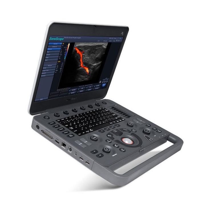 Sonoscape X5 - Powerful Ultrasound | Dicom Solutions