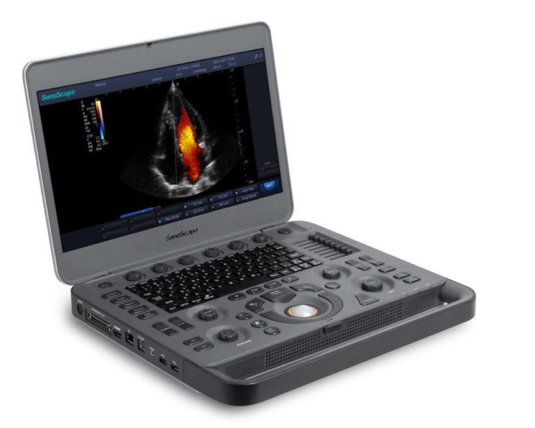 Sonoscape X5 - Powerful Ultrasound | Dicom Solutions