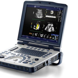 GE Logiq V1 Portable Ultrasound